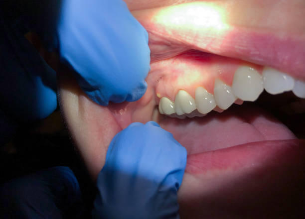 Best Pediatric Emergency Dentist in Fountain Inn, SC