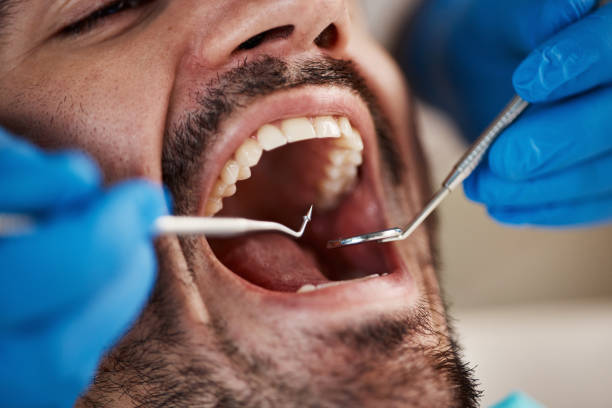 Best After-Hours Emergency Dentist in Fountain Inn, SC